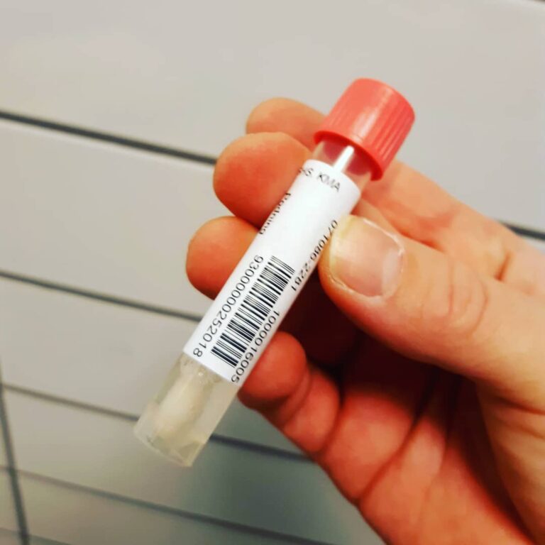 Starter året ud med en ekstra nattevagt, grundet COVID-19 hos kollega. Og så endnu en podning da der nu ses udbredt COVID-19 blandt medarbejderne #covid19dk #yngrelæger #læger #coronadk